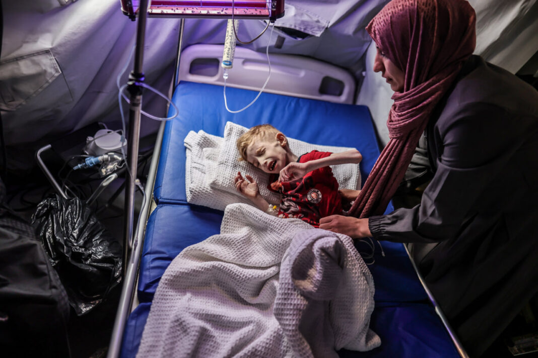 gázai beteg gyermekek